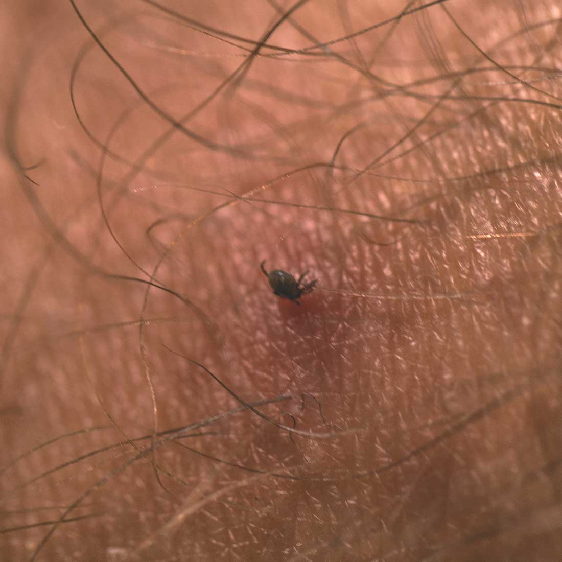 Flåttfjerner (Kompakt kort) – Life Systems