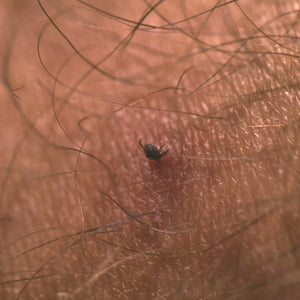 Flåttfjerner (Kompakt kort) – Life Systems
